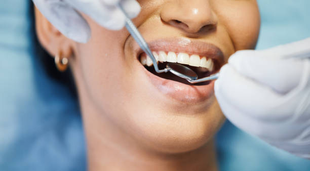 Best Chipped Tooth Repair Near Me  in Yardley, PA