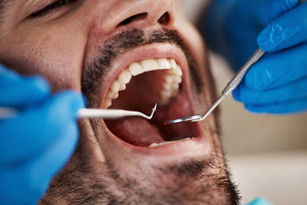 Best Tooth Infection Emergency Dentist  in Yardley, PA