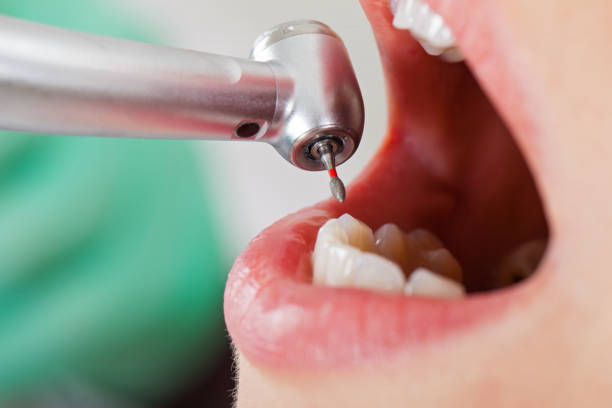 Best Knocked-Out Tooth Emergency  in Yardley, PA